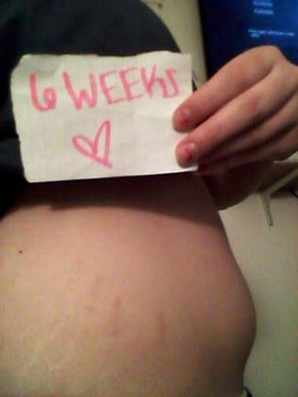 Jacob Tanner Hudson Jr. - Photo 15