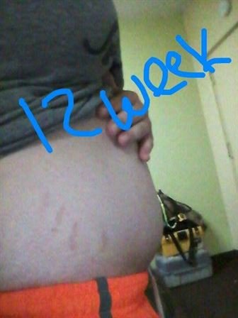 Jacob Tanner Hudson Jr. - Photo 23